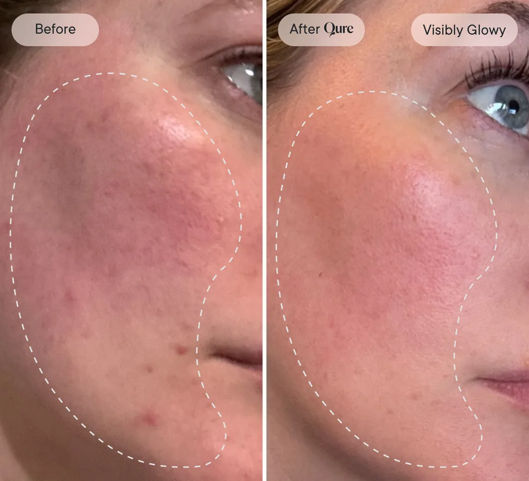 Before and after: visibly glowy skin